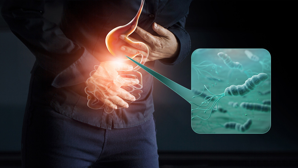 รูปภาพในบทความ แบคทีเรีย เฮลิโคแบคเตอร์ ไพโลไร อีกหนึ่งสาเหตุของโรคกระเพาะอาหาร