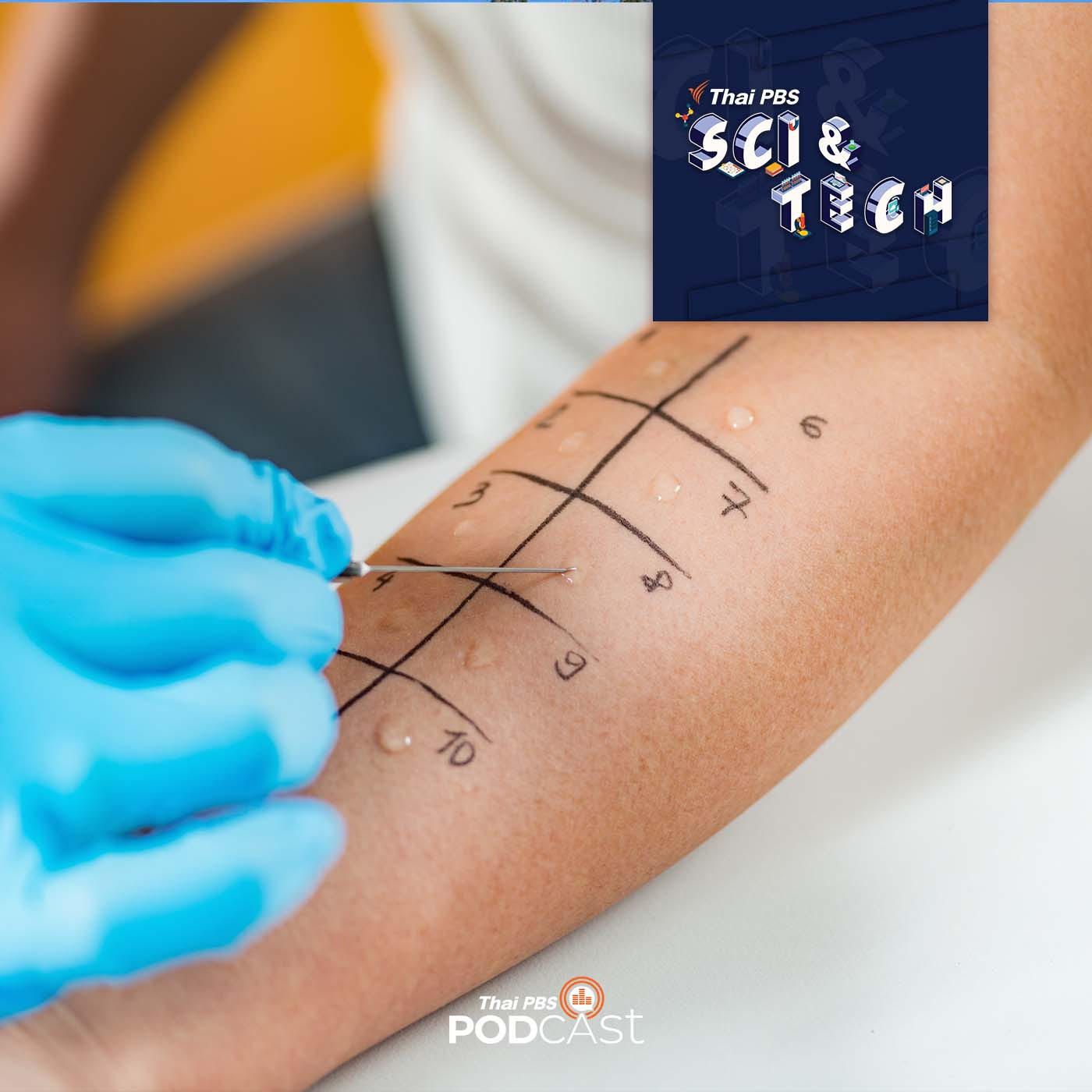 Sci &amp; Tech EP. 614: อาการแพ้ (allergy) episode artwork