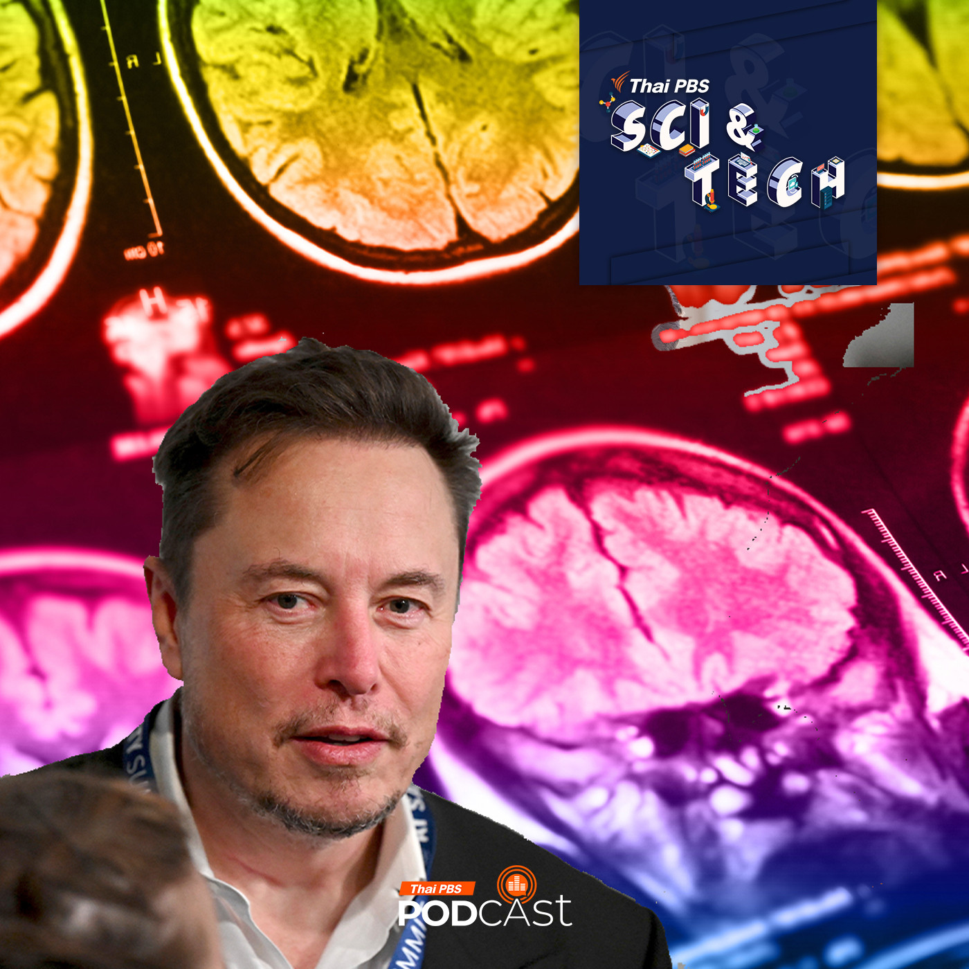 Sci &amp; Tech EP. 794: Neuralink ทดสอบฝังชิปกับสมองมนุษย์คนแรก episode artwork