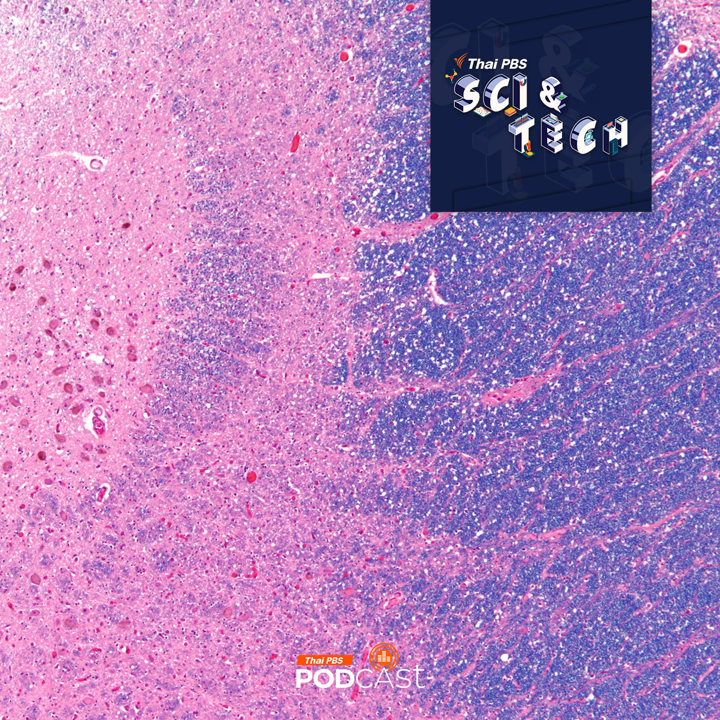 Sci &amp; Tech EP. 843: จุดสีน้ำเงินเล็ก ๆ ในก้านสมอง กับความสำคัญที่ไม่เล็กต่อการนอน episode artwork