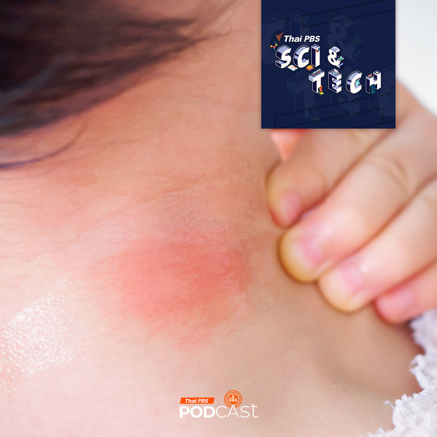 Sci &amp; Tech EP. 850: เพราะอะไรร่างกายต้อง "อักเสบ" episode artwork