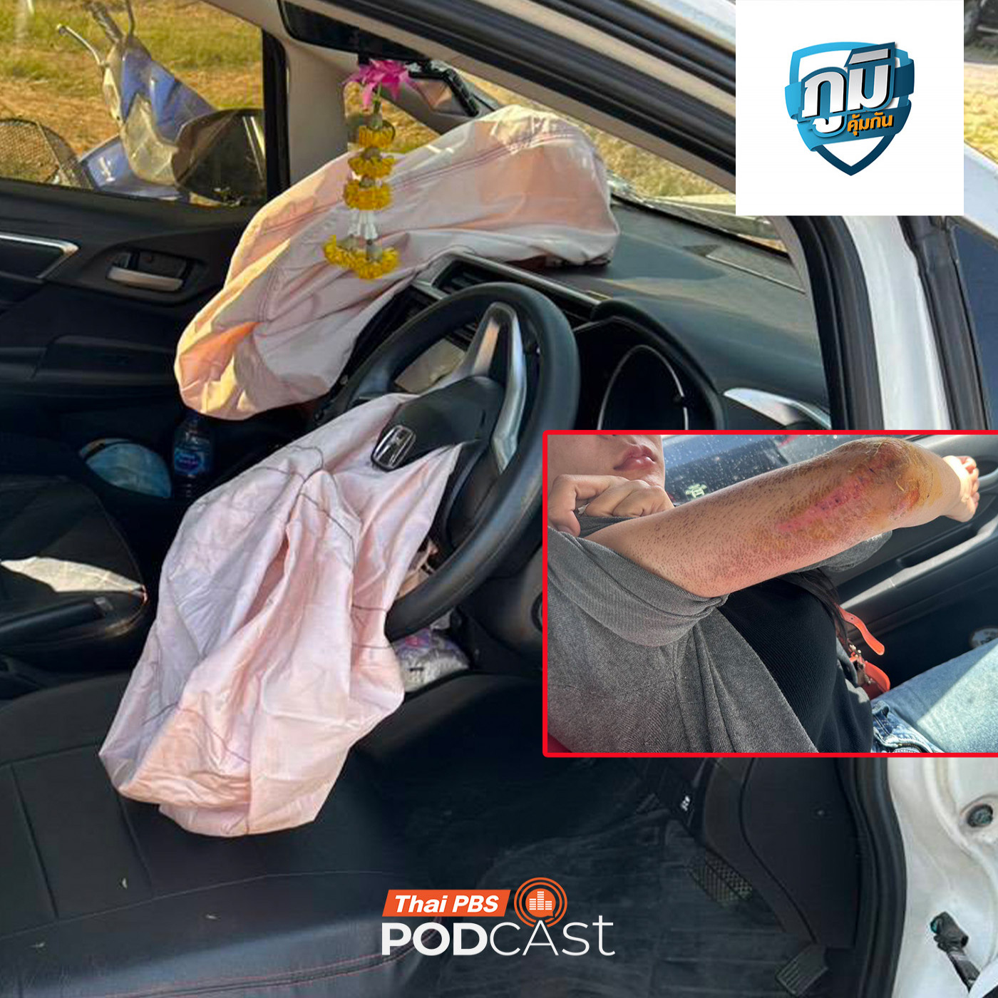 ภูมิคุ้มกัน : ถุงลมนิรภัยทาคาตะระเบิดใส่ผู้ใช้รถยนต์อีกแล้ว / ร้องเรียนเซลส์ขายรถยนต์หลอกให้โอนเงินค่าอุปกรณ์ทั้งที่เป็นของแถม / ดื่มกาแฟตอนท้องว่างอาจทำให้กระเพาะทะลุได้ จริงหรือ ภูมิคุ้มกัน : ถุงลมนิรภัยทาคาตะระเบิดใส่ผู้ใช้รถยนต์อีกแล้ว / ร้องเรียนเซลส์ขายรถยนต์หลอกให้โอนเงินค่าอุปกรณ์ทั้งที่เป็นของแถม / ดื่มกาแฟตอนท้องว่างอาจทำให้กระเพาะทะลุได้ จริงหรือ