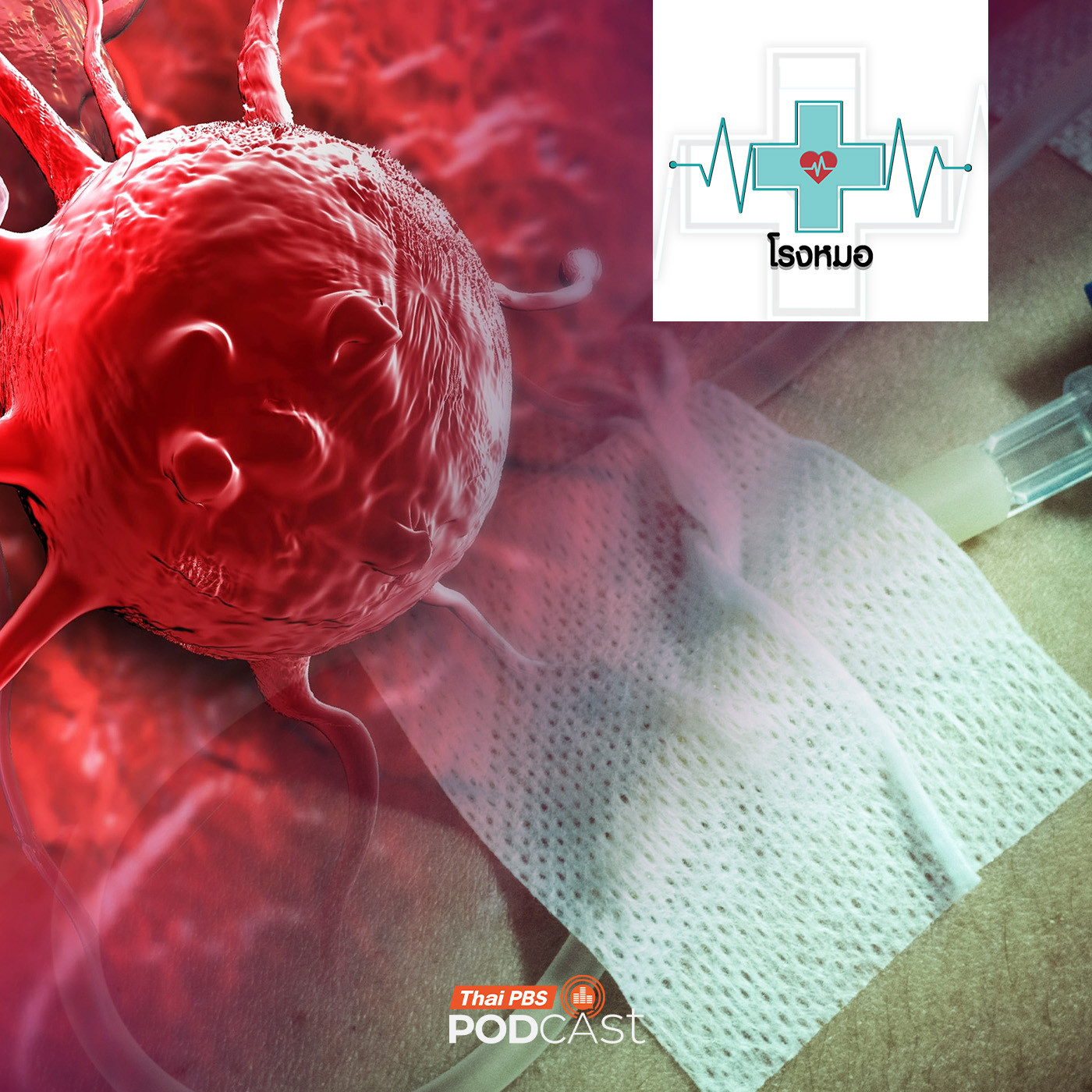 โรงหมอ EP. 1189: มะเร็ง ไม่มีสัญญาณเตือนแต่ต้องรู้ทันก่อนสาย